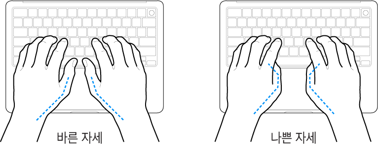 엄지손가락의 바른 위치와 잘못된 위치를 보여주는 키보드 위의 손.