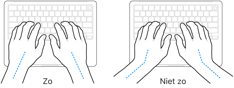 Handen boven een toetsenbord, waarbij de goede en verkeerde stand van de handen en polsen wordt aangegeven.