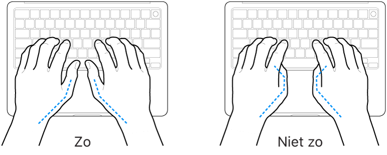 Handen boven een toetsenbord, waarbij de goede en verkeerde stand van de duimen wordt aangegeven.