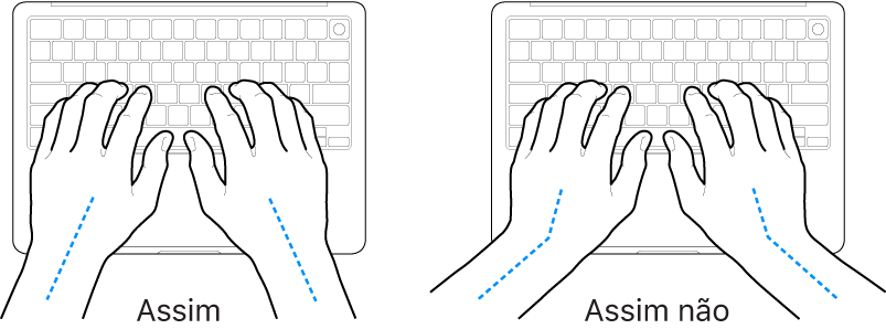 As mãos posicionadas sobre um teclado a mostrar alinhamentos corretos e incorretos das mãos e dos pulsos.