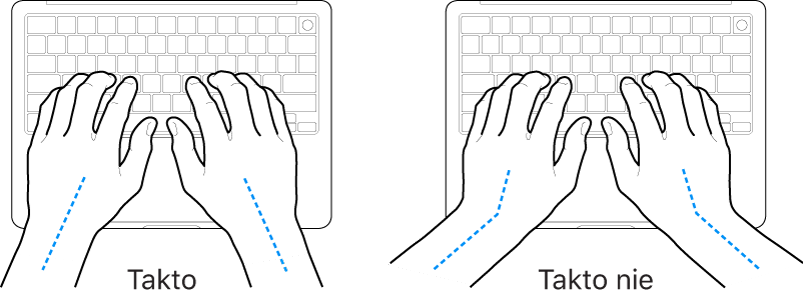 Ruky položené na klávesnici znázorňujúce správnu a nesprávnu polohu zápästia a ruky.