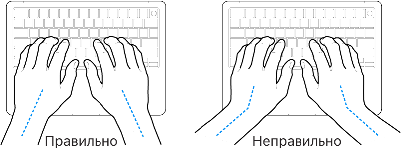 Руки розташовано над клавіатурою й показано правильне та неправильне положення кистей і рук.