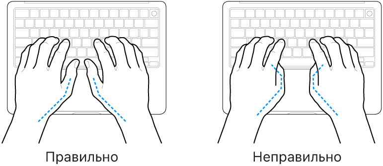 Руки розташовано над клавіатурою й показано правильне та неправильне положення великих пальців.