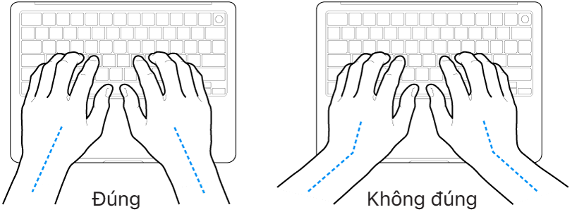 Các bàn tay đặt phía trên bàn phím, minh họa cách đặt cổ tay và bàn tay đúng và sai.