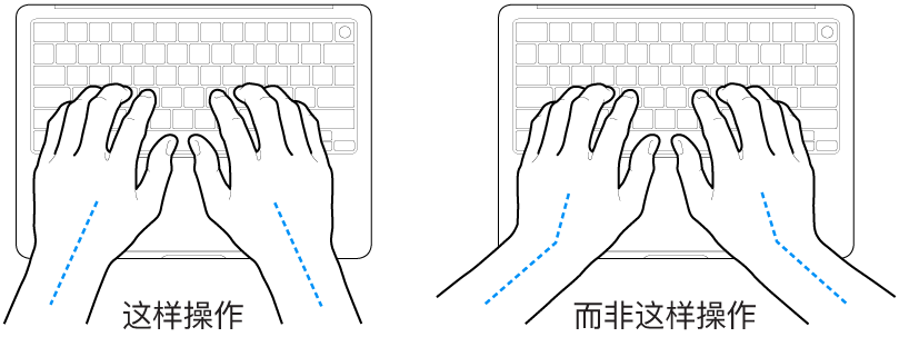 手掌放在键盘上方,显示手腕和手掌的正确对齐位置和错误对齐位置。
