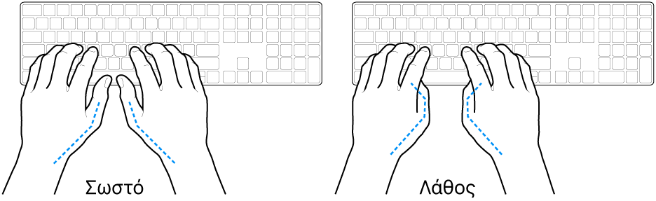 Χέρια τοποθετημένα επάνω σε ένα πληκτρολόγιο, που δείχνουν τη σωστή και τη λανθασμένη θέση των αντίχειρων.