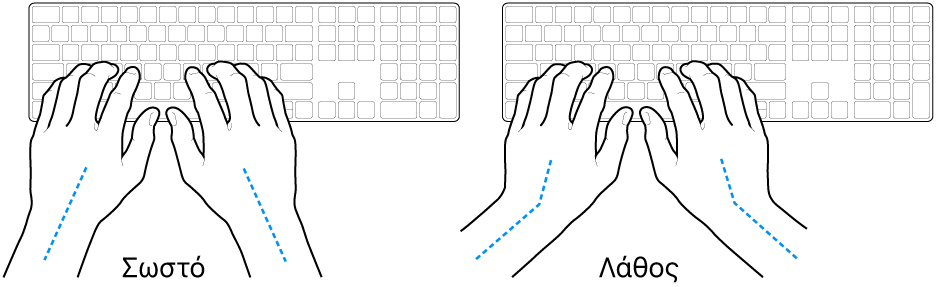 Χέρια τοποθετημένα επάνω σε ένα πληκτρολόγιο, που δείχνουν τη σωστή και τη λανθασμένη θέση των καρπών σε σχέση με τα χέρια.
