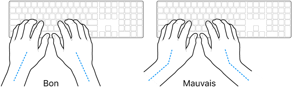 Mains placées sur un clavier, montrant le bon et le mauvais alignement des poignets et des mains.