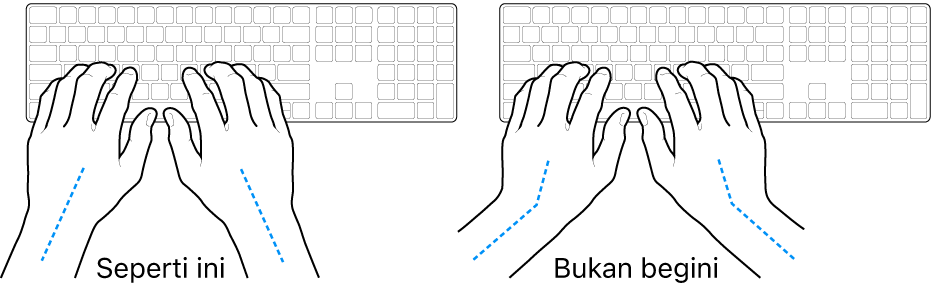 Tangan diposisikan di atas papan ketik, menampilkan penyejajaran pergelangan tangan dan tangan yang benar dan salah.