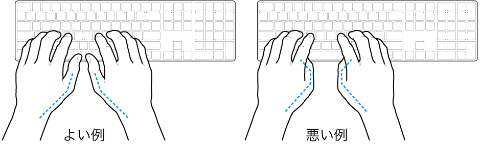 キーボードに置かれた手。親指の適切な位置と不適切な位置を示しています。