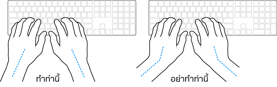 มือวางอยู่เหรือแป้นพิมพ์ แสดงตำแหน่งการวางข้อมือและแขนที่ถูกต้องและไม่ถูกต้อง