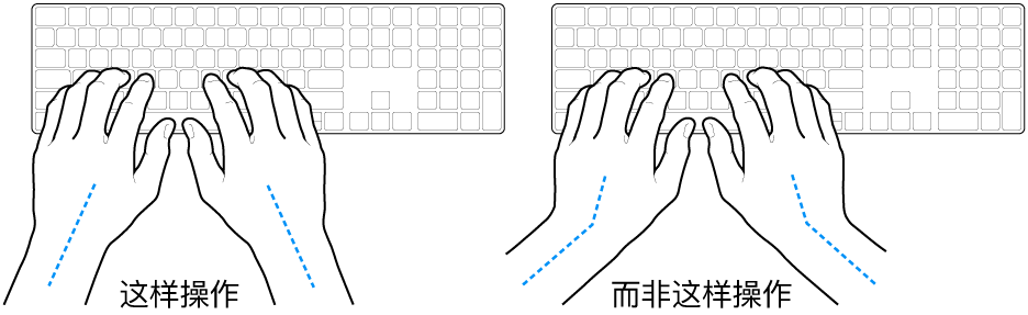 手掌放在键盘上方,显示手腕和手掌的正确对齐位置和错误对齐位置。