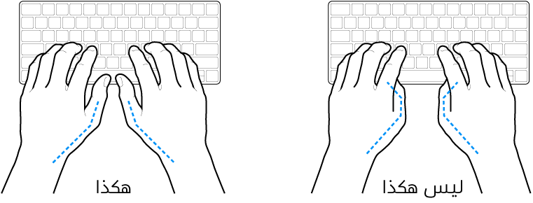 يدان موضوعتان على لوحة مفاتيح، ويظهر الوضع الصحيح وغير الصحيح للإبهامين.