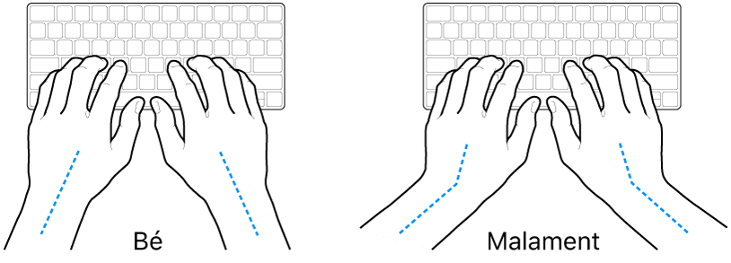 Unes mans posades sobre un teclat mostrant l’alineació correcta i incorrecta del canell i la mà.