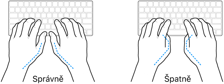 Ruce nad klávesnicí znázorňující správnou a nesprávnou polohu palců