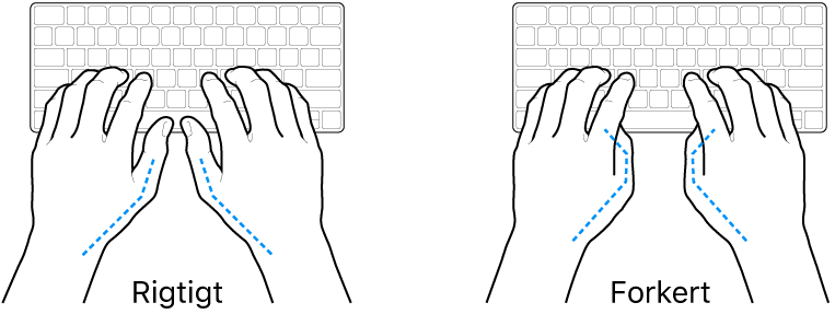 Hænder anbragt over et tastatur med rigtig og forkert position af tommelfingre.