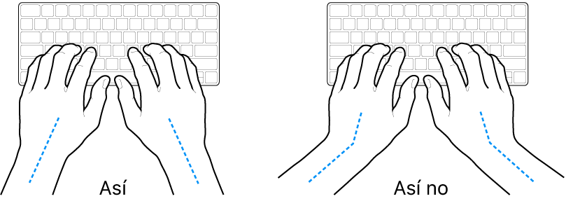 Manos posicionadas sobre un teclado, mostrando la alineación correcta e incorrecta de la mano y la muñeca.