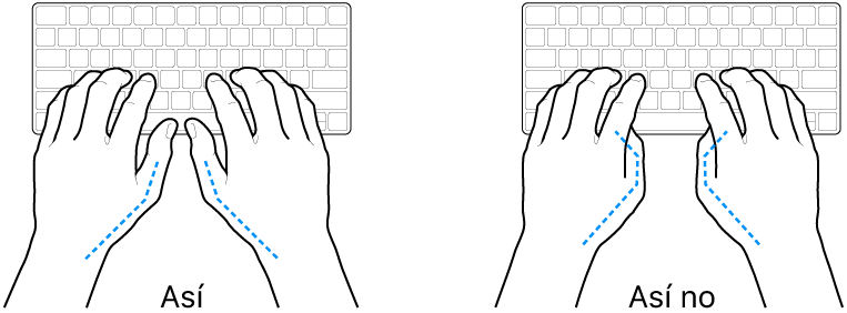 Manos colocadas sobre un teclado que muestran una posición correcta e incorrecta de los pulgares.