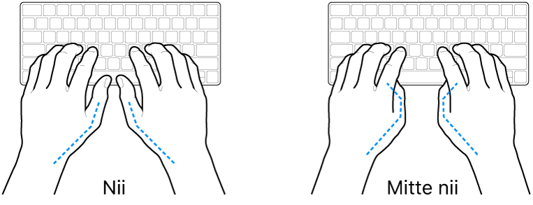 Klaviatuurile paigutatud käed, mis näitavad õiget ja valet pöidlate joondust.