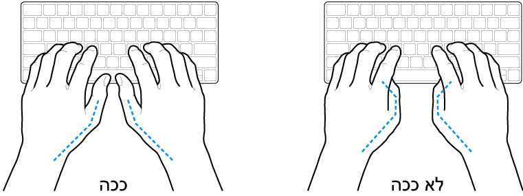 ידיים מעל מקלדת, להדגמת מנח נכון ומנח שגוי של האגודלים.