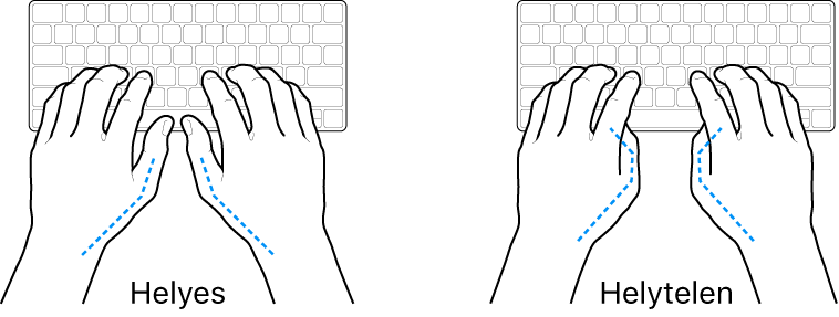Kéz a billentyűzeten – a hüvelykujj helyes és helytelen tartásának bemutatása.