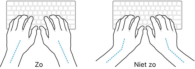 Handen boven een toetsenbord, waarbij de goede en verkeerde stand van de handen en polsen wordt aangegeven.