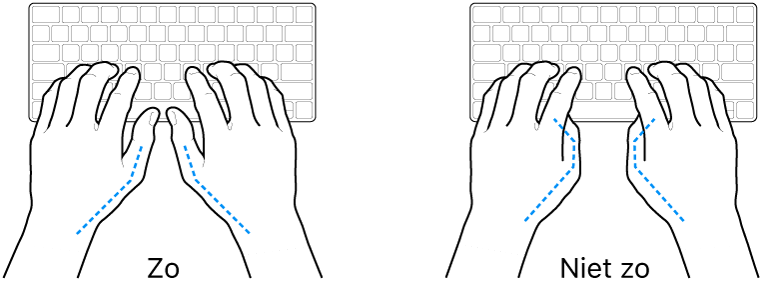 Handen boven een toetsenbord, waarbij de goede en verkeerde stand van de duimen wordt aangegeven.