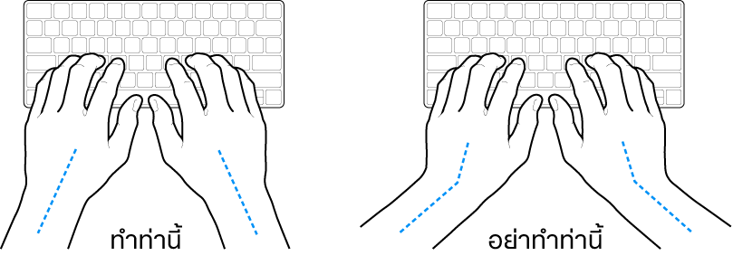 มือวางอยู่เหรือแป้นพิมพ์ แสดงตำแหน่งการวางข้อมือและแขนที่ถูกต้องและไม่ถูกต้อง