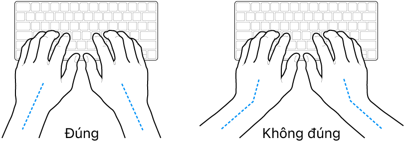 Các bàn tay đặt phía trên bàn phím, minh họa cách đặt cổ tay và bàn tay đúng và sai.