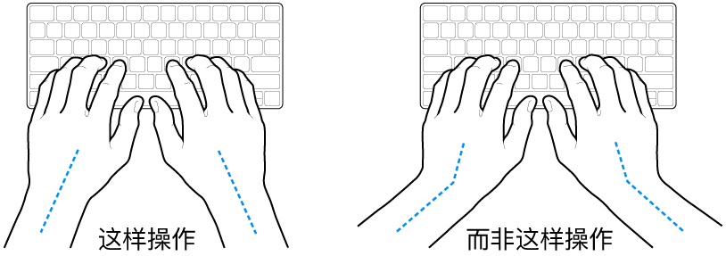 手掌放在键盘上方,显示手腕和手掌的正确对齐位置和错误对齐位置。
