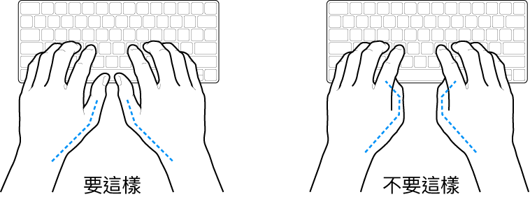 雙手置於鍵盤上,分別顯示正確與不正確的大腿姿勢。