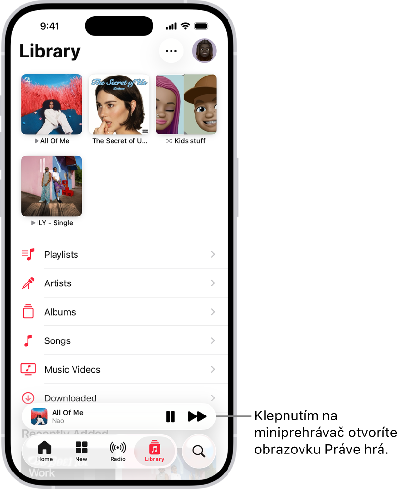 Obrazovka Knižnica s miniprehrávačom v spodnej časti. Miniprehrávač zobrazuje názov skladby, ktorá práve hrá. Napravo od názvu skladby sa nachádzajú tlačidlá Pozastaviť a Ďalšia skladba. Klepnutím na miniprehrávač otvoríte obrazovku Práve hrá.