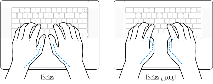 يدان موضوعتان على لوحة مفاتيح، ويظهر الوضع الصحيح وغير الصحيح للإبهامين.