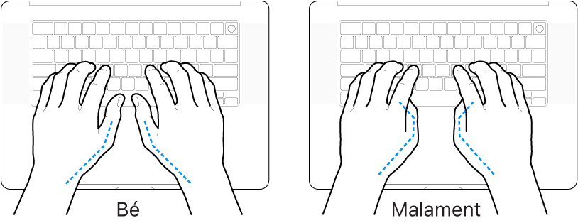 Unes mans posades sobre un teclat mostrant la posició correcta i incorrecta dels polzes.