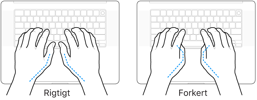 Hænder anbragt over et tastatur med rigtig og forkert position af tommelfingre.