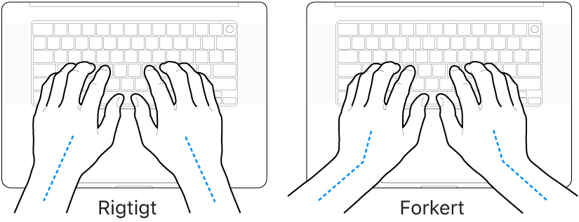 Hænder anbragt over et tastatur med rigtig og forkert position af håndled og hånd.