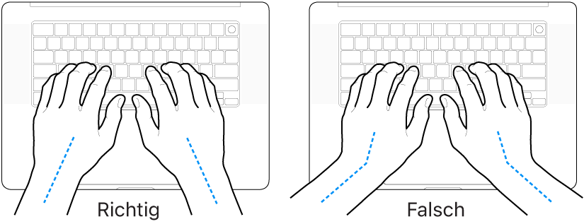 Tastatur und Hände in richtiger und falscher Haltung von Handgelenk und Händen