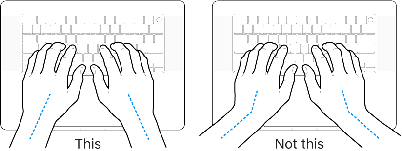 Hands positioned over a keyboard, showing correct and incorrect wrist and hand alignment.