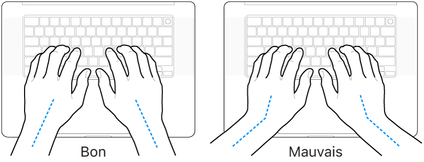 Mains placées sur un clavier, montrant le bon et le mauvais alignement des poignets et des mains.