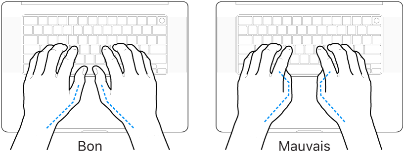 Mains placées sur un clavier, montrant la bonne et la mauvaise position des pouces.