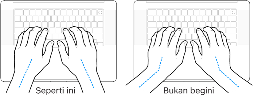 Tangan diposisikan di atas papan ketik, menampilkan penyejajaran pergelangan tangan dan tangan yang benar dan salah.