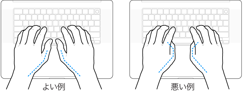キーボードに置かれた手。親指の適切な位置と不適切な位置を示しています。