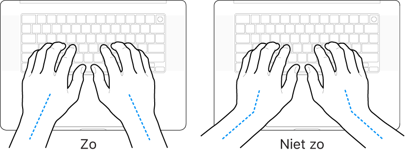 Handen boven een toetsenbord, waarbij de goede en verkeerde stand van de handen en polsen wordt aangegeven.