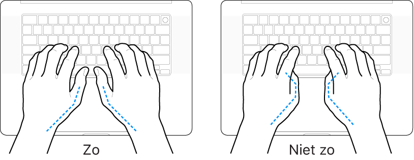 Handen boven een toetsenbord, waarbij de goede en verkeerde stand van de duimen wordt aangegeven.