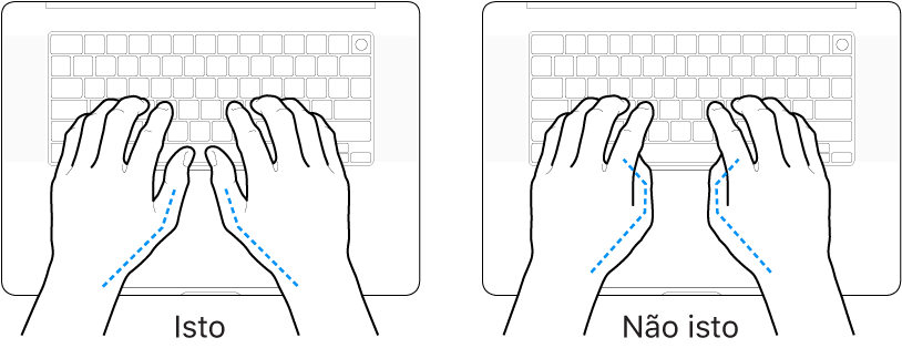 Mãos posicionadas sobre um teclado, mostrando os alinhamentos correto e incorreto dos polegares.