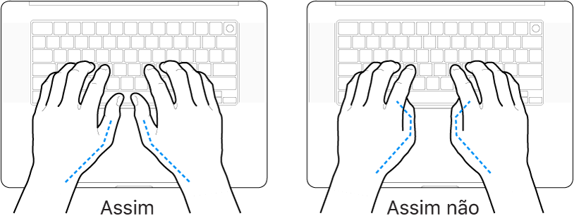 As mãos posicionadas sobre um teclado a mostrar a colocação correta e incorreta dos polegares.