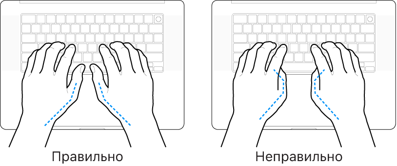 Руки над клавиатурой. Показано правильное и неправильное положение большого пальца.