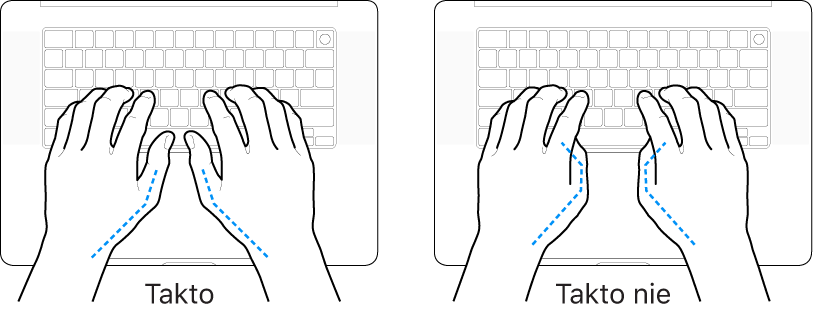 Ruky položené na klávesnici znázorňujúce správnu a nesprávnu polohu palcov.