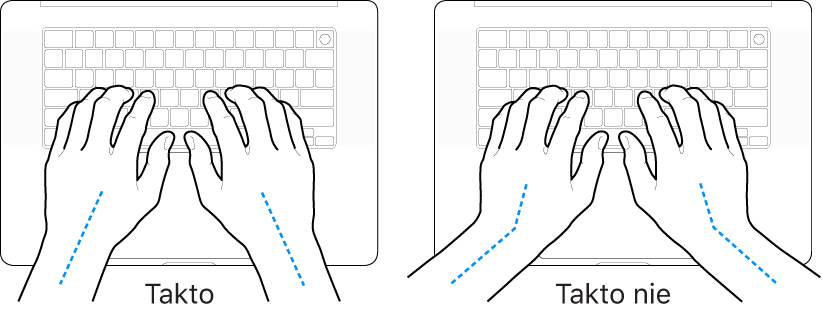 Ruky položené na klávesnici znázorňujúce správnu a nesprávnu polohu zápästia a ruky.