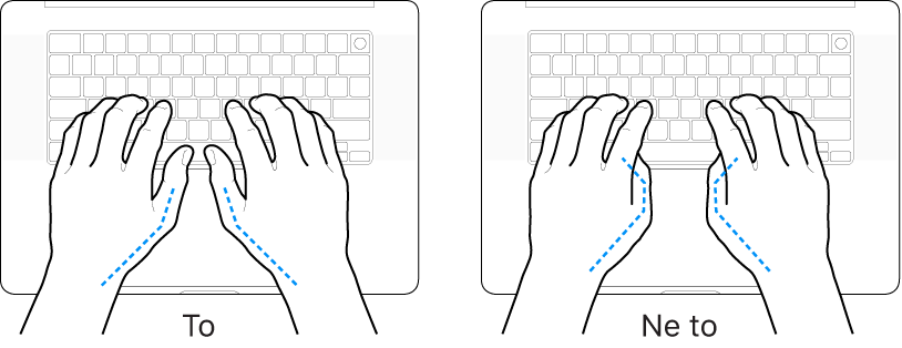 Dlani nad tipkovnico, ki prikazujeta pravilno in nepravilno držo palcev.